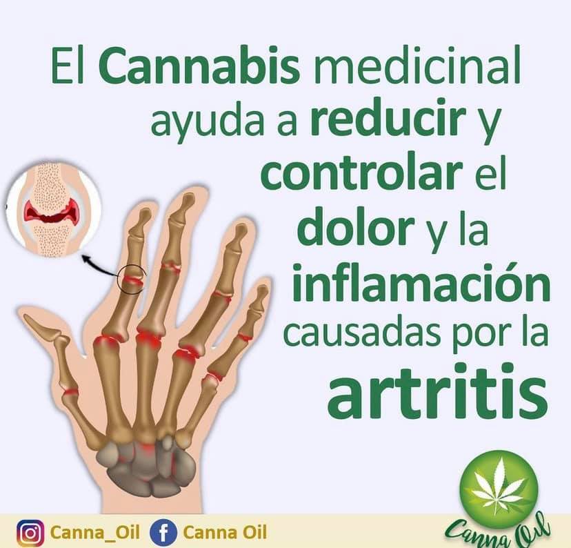 El cannabis medicinal y la artritis